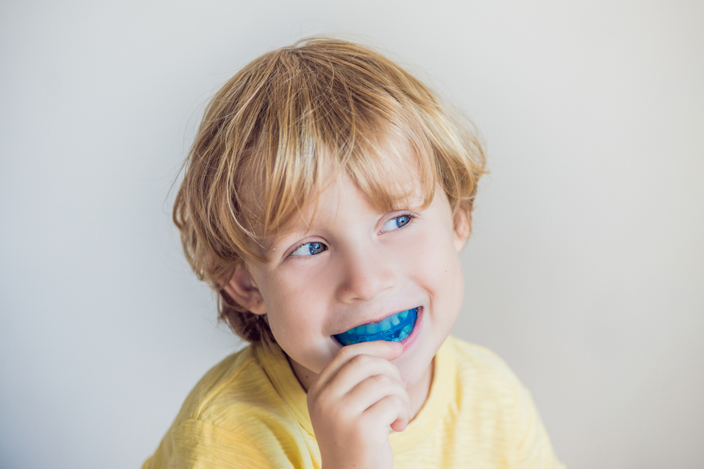 Custom Mouthguards in Shoalhaven